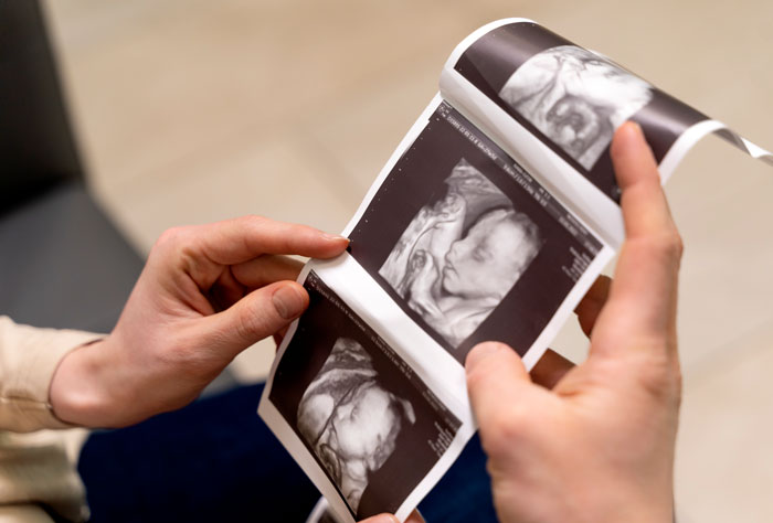 Person holding ultrasound images of an unborn child, examining the photos closely.