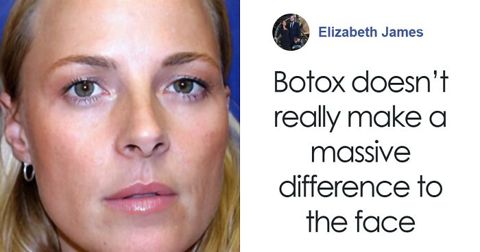 Twin Study Of Botox vs. Natural Aging Sparks Debate: “Beauty Is Defined By So Much More”