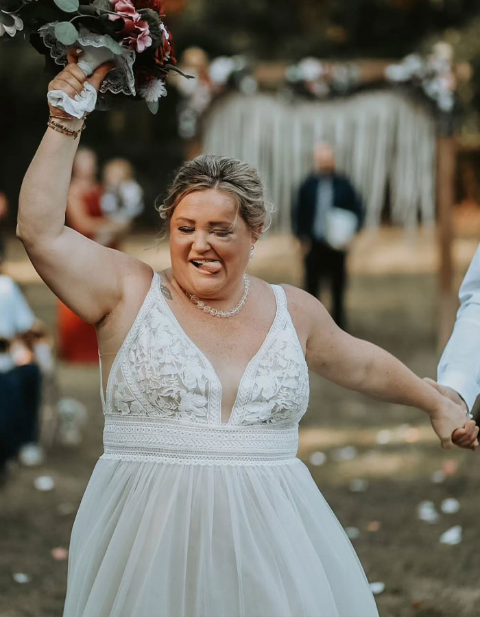 "That Artist Is A Wizard!": Bride With Facial Bruises Reveals Stunning Makeup Transformation