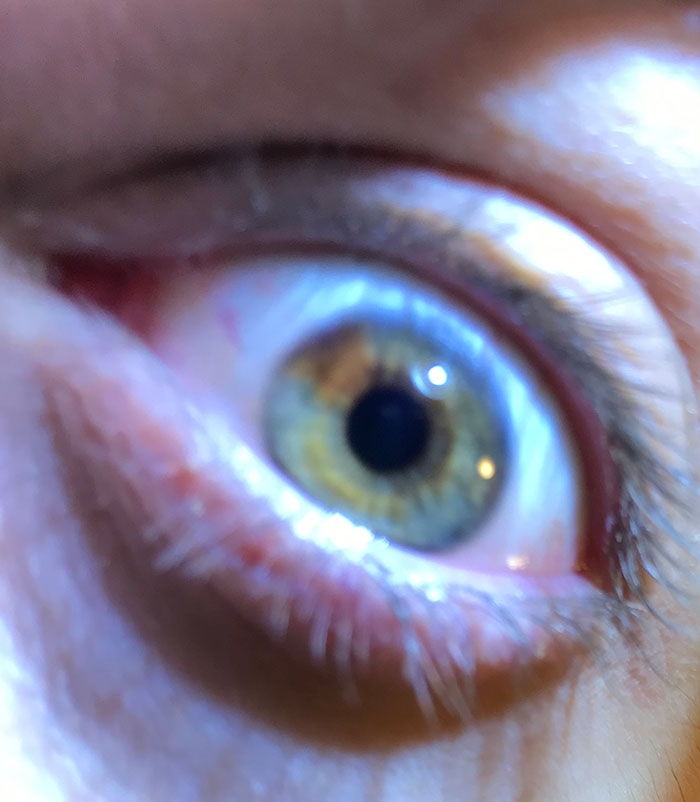 Close-up of a human eye with rare green and brown hues, highlighting unique statistics that make people special.