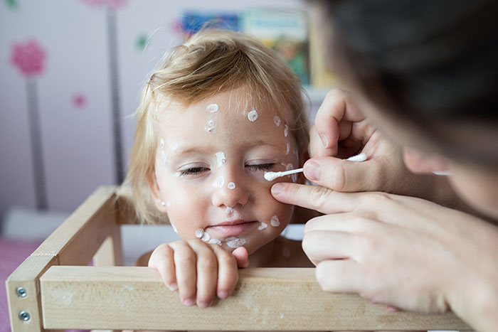 Child with unique spots on face being treated, highlighting unique rare statistics.