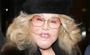 “Catwoman” Jocelyn Wildenstein, 84, Flaunts Smooth Skin While Out In Paris With Fiancé, 57