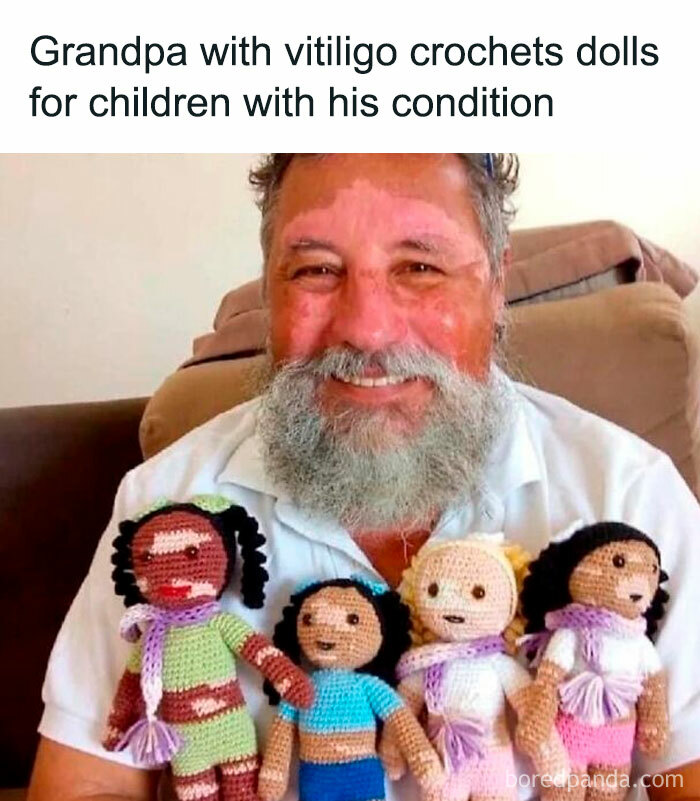 Elderly man with vitiligo crochets dolls for children with the condition, displaying wholesome support online.