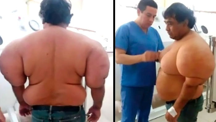 Man with a rare medical condition being examined by a doctor, showcasing the human body's complexity.