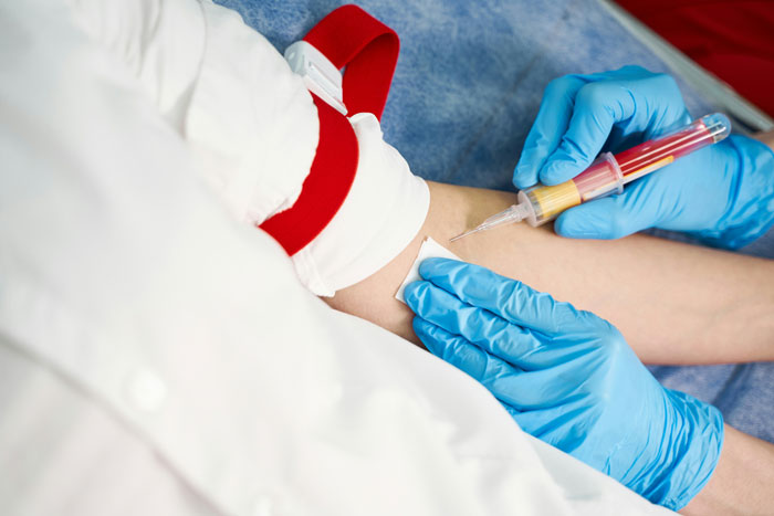 Person in white coat drawing blood from arm; close-up on needle and blue gloves.