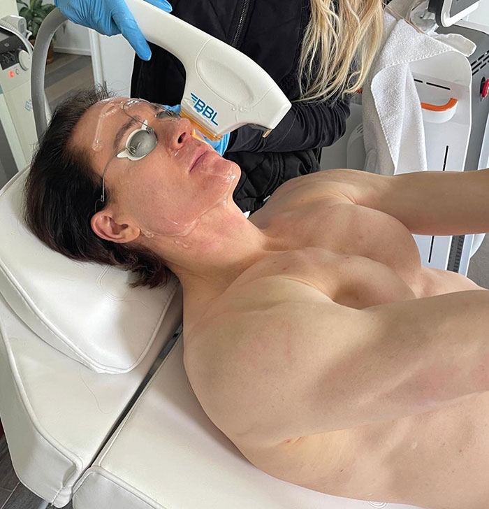 Individual receiving anti-aging treatment using laser therapy, lying calmly on a clinic chair.