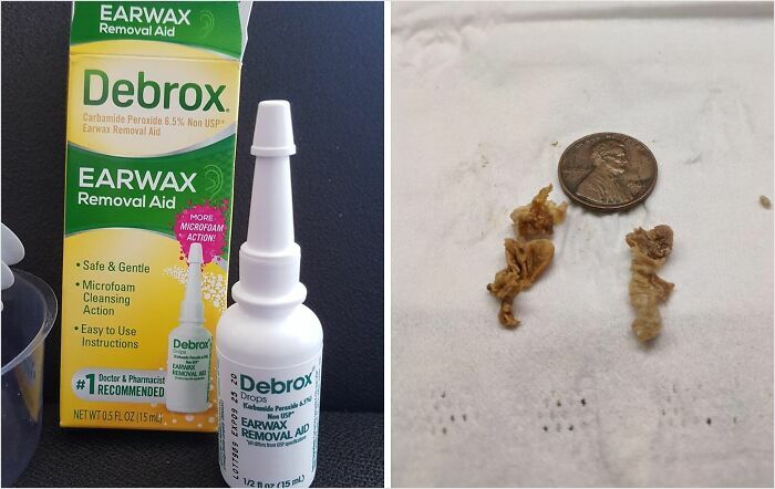 Debrox earwax removal product next to a penny and earwax, showcasing personal care products.