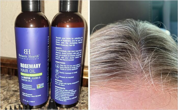 Bottles of rosemary hair oil and a person's scalp showing gray hair, promoting personal care products for hair health.