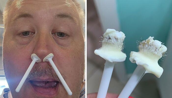 Man using poorly designed personal care products for nose cleaning.