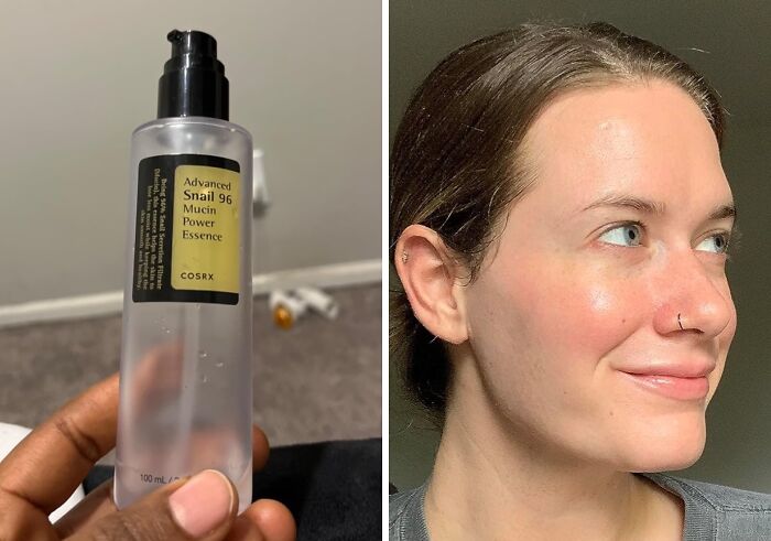 Bottle of snail mucin essence and a person with glowing skin, showcasing personal-care-products benefits.