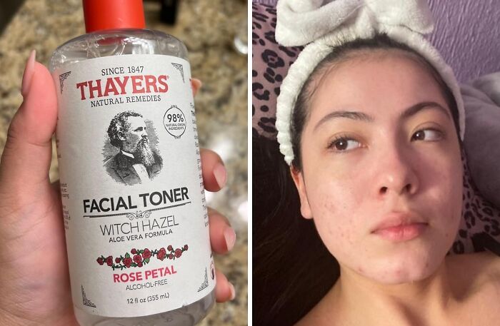 Person using Thayers witch hazel facial toner, showcasing personal-care-products skincare routine.