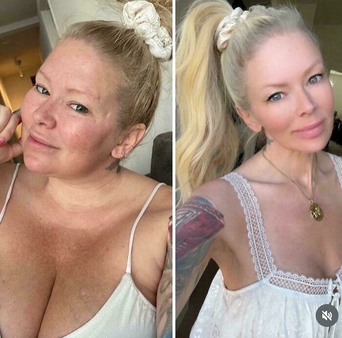 Op Posted This To Show How Much Better She Looks After “Taking Care Of Herself”