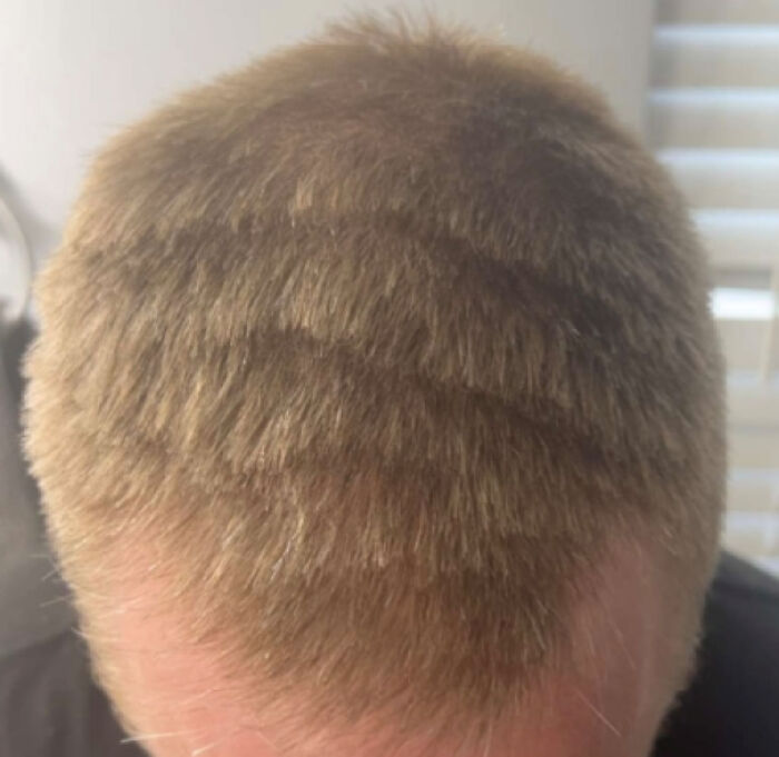 Close-up of a haircut with uneven patches, illustrating a tragic hair accident.