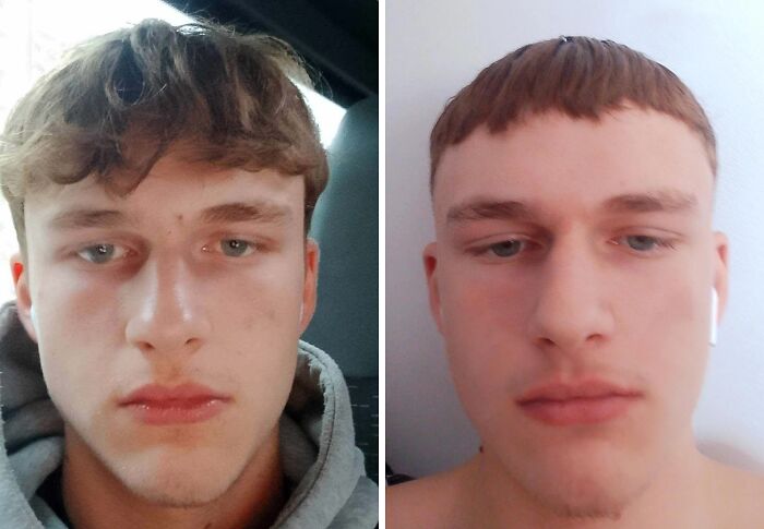 Two photos of a person showing different tragic hair accidents.