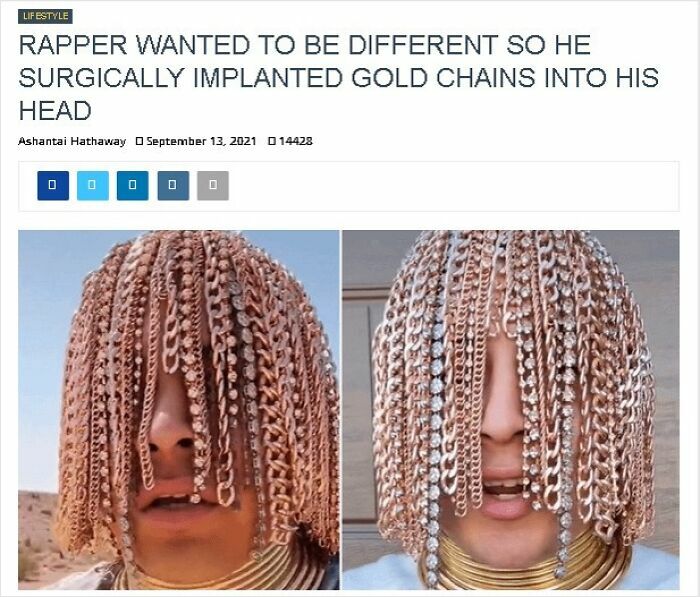 Person with gold chains implanted into scalp, highlighting a unique hairstyle choice.