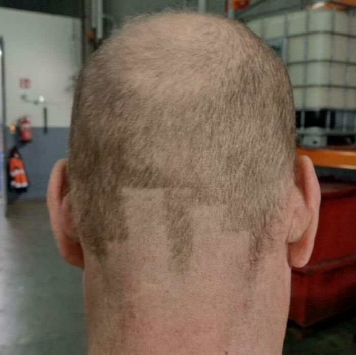 Uneven haircut at the back of a person's head, illustrating a tragic hair accident.