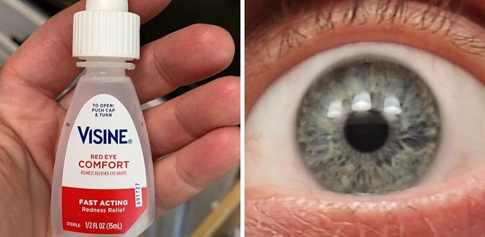 Bottle of eye drops for redness relief, held by a hand, next to a close-up of an eye. Related to unavoidable body issues.