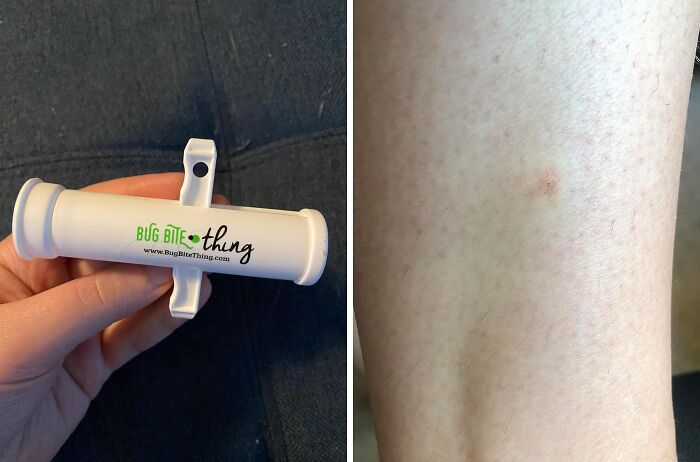 Hand holding a bug bite suction tool, next to an arm with a small bite mark, showcasing a borderline genius invention.