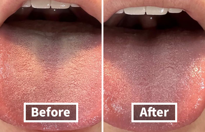 Before and after images of a tongue, illustrating changes related to unavoidable body issues.