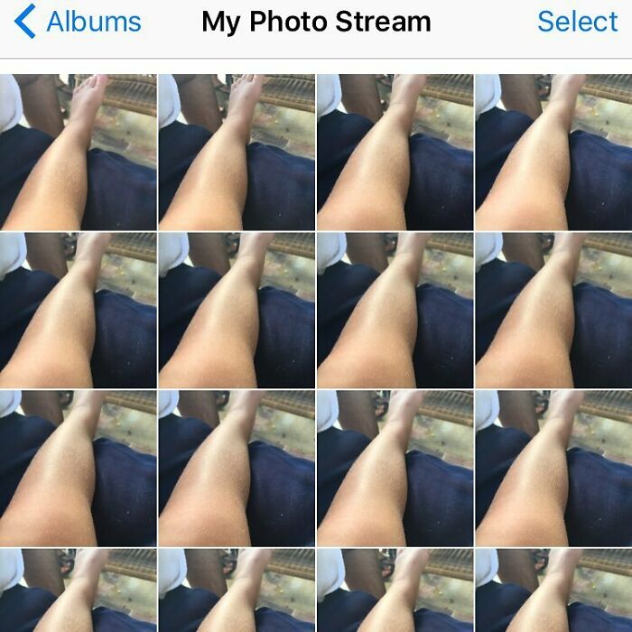 Funny-Camera-Roll-Finds: Repeated selfies of a leg in a photo stream, highlighting humorous photo mishaps.