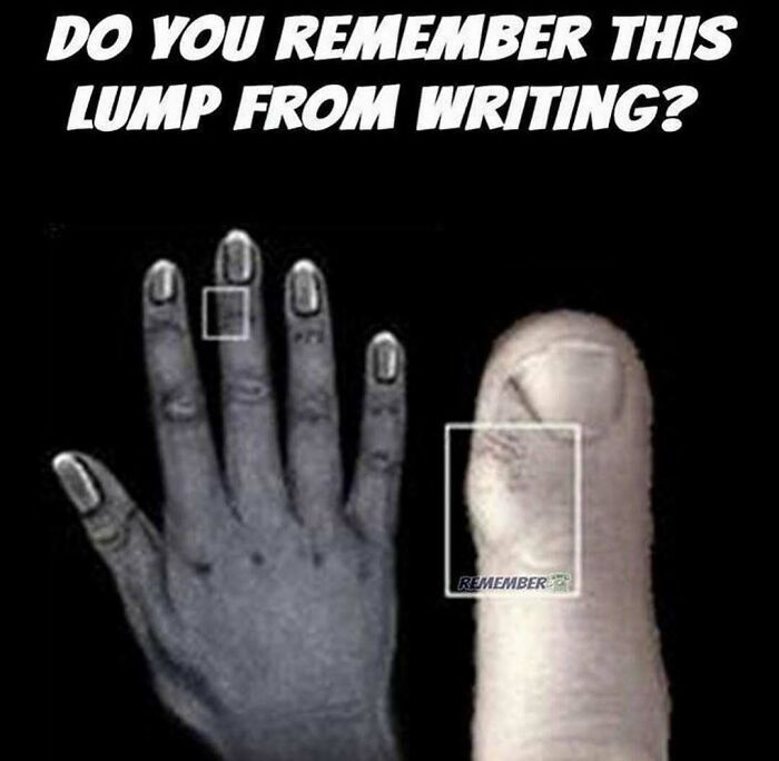 Nostalgic meme of fingers with callus from writing takes you back.