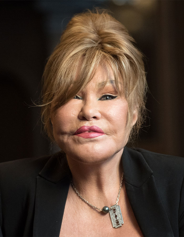 'Catwoman' Jocelyn Wildenstein, Notorious For Extreme Plastic Surgeries, Passes Away At 84