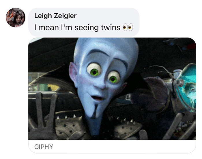 Megamind gif with text comment comparing hair transplant results.