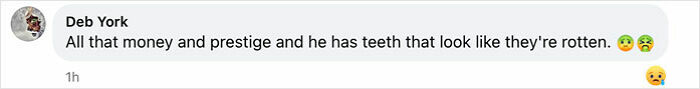 Netizen comments on the shortage of dentists in the UK, referencing a portrait with a critique of teeth appearance.