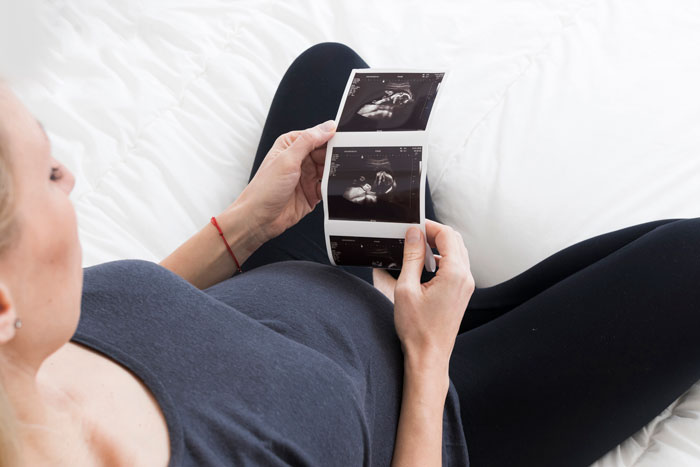 Woman holding ultrasound photos, reflecting on bereavement and miscarriage.