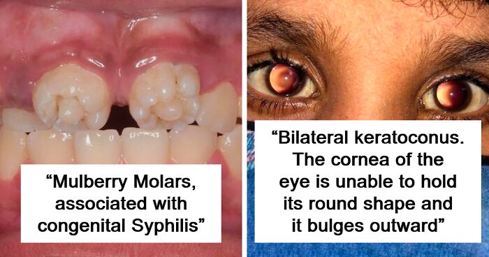 These 59 Unbelievable Medical Cases Might Leave You Both Amazed And Curious (New Pics)