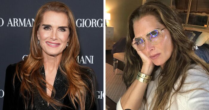 Brooke Shields Claims Plastic Surgeon Gave Her A “Bonus” During Labial Surgery Without Consent