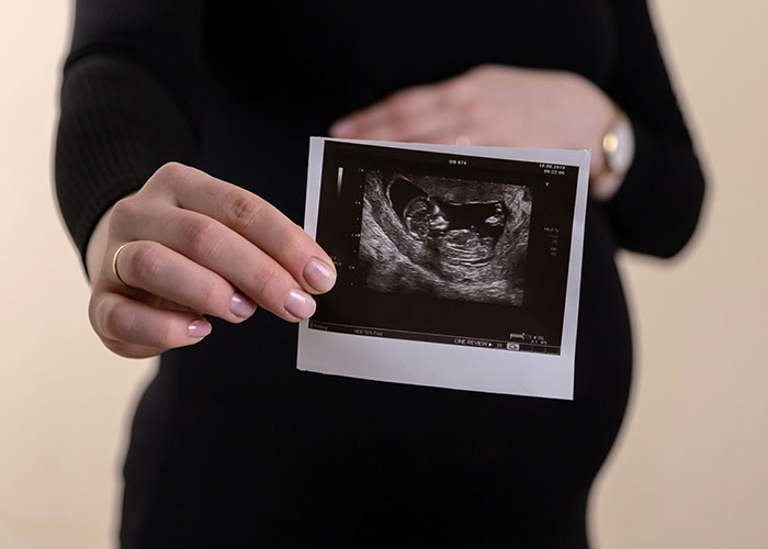 Pregnant woman in black dress holding an ultrasound photo, highlighting unsettling medical facts.