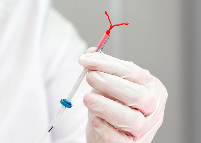 Gloved hand holding an IUD device, showcasing a normal medical tool that can seem pretty horrific.