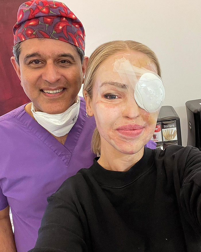 A woman with an eye patch smiles beside a doctor in purple scrubs, sharing health update on eye recovery.