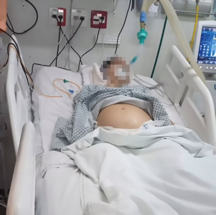 A pregnant woman on life support in a hospital bed, surrounded by medical equipment.