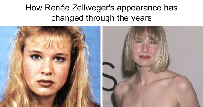 How Renée Zellweger’s Appearance Has Changed From Bridget Jones To Now