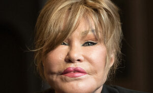 ‘Catwoman’ Jocelyn Wildenstein, Notorious For Extreme Plastic Surgeries, Passes Away At 84