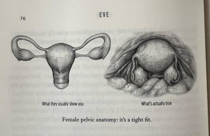 Diagram comparing typical and realistic depictions of female pelvic anatomy.