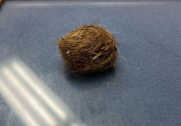 Tissue sample with hair in a container, related to niche facts about the female body.