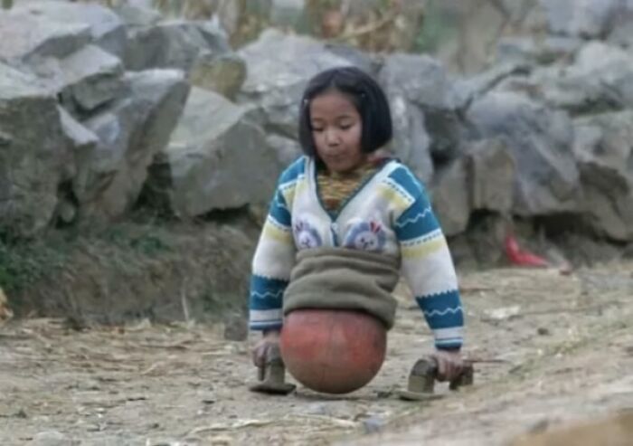 A child with walking aids and a unique contraption, demonstrating an interesting adaptation outdoors.