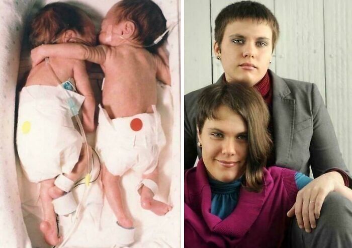 Two newborns in a hospital, and two women posing together, illustrating interesting facts about their connection.