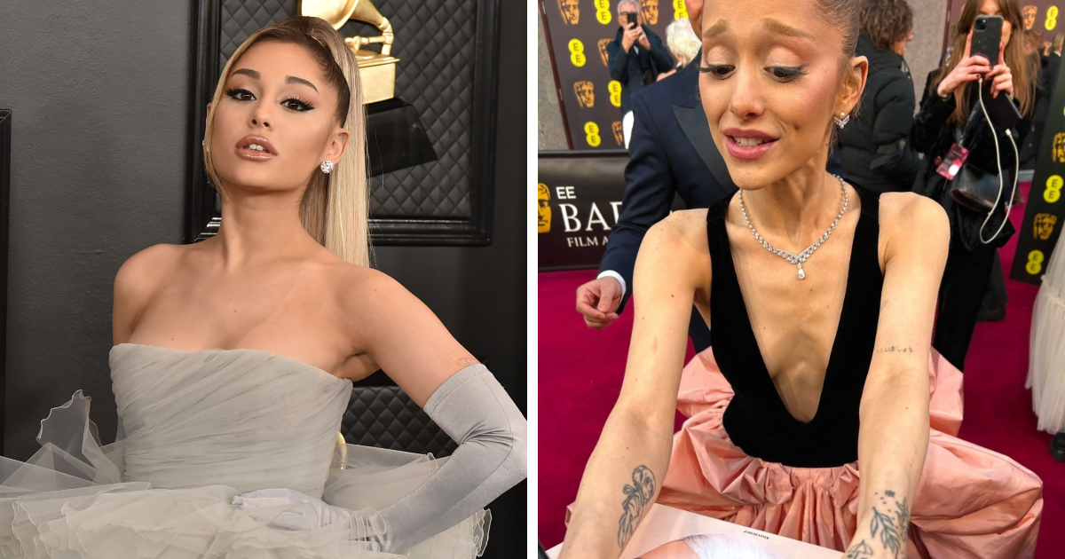 “Not Normal”: Ariana Grande Sparks Concern With BAFTAs Image