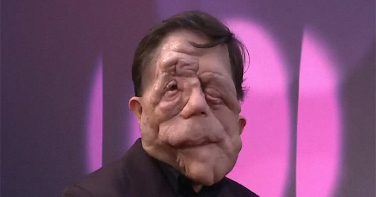 “Not The Victim Here”: Adam Pearson Refuses To Back Down To Troll Despite “Anti-Trans” Claim