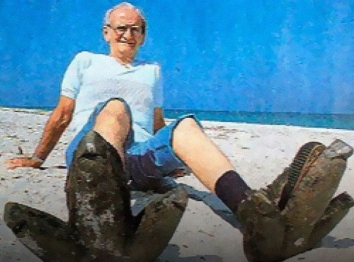 Man sitting on beach with large metal objects on his feet, illustrating interesting facts.