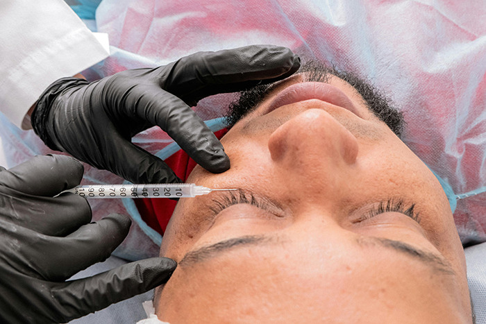 Man undergoing plastic surgery procedure, lying on a table, with a syringe near his eye.