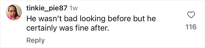 Comment praising man's plastic surgery transformation results, noting a positive change in appearance.