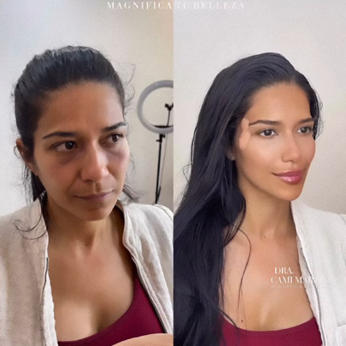 Plastic surgery transformation showcasing youthful makeover with before and after images.