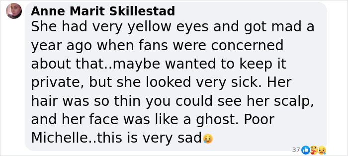 Comment expressing concern for Michelle Trachtenberg&rsquo;s health, mentioning yellow eyes and thin hair.