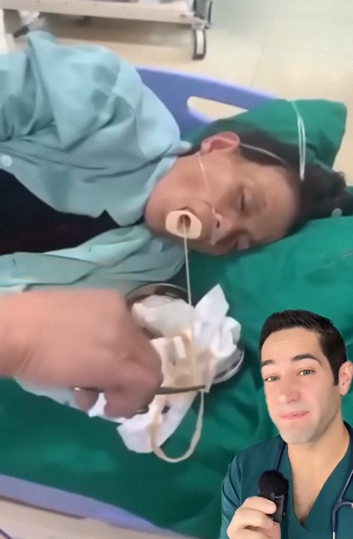 Disturbing Video Of Tapeworm Being Extracted From Woman's Mouth Is Going Viral