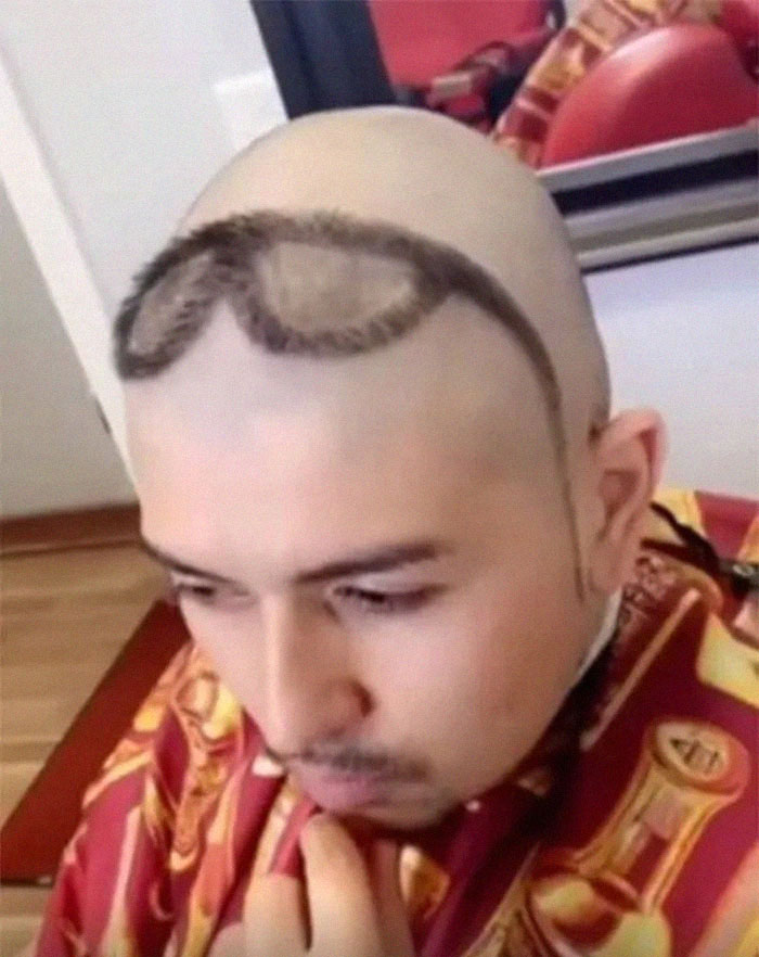 Man with a funny hair fail, showing a unique hairstyle pattern on a shaved head.